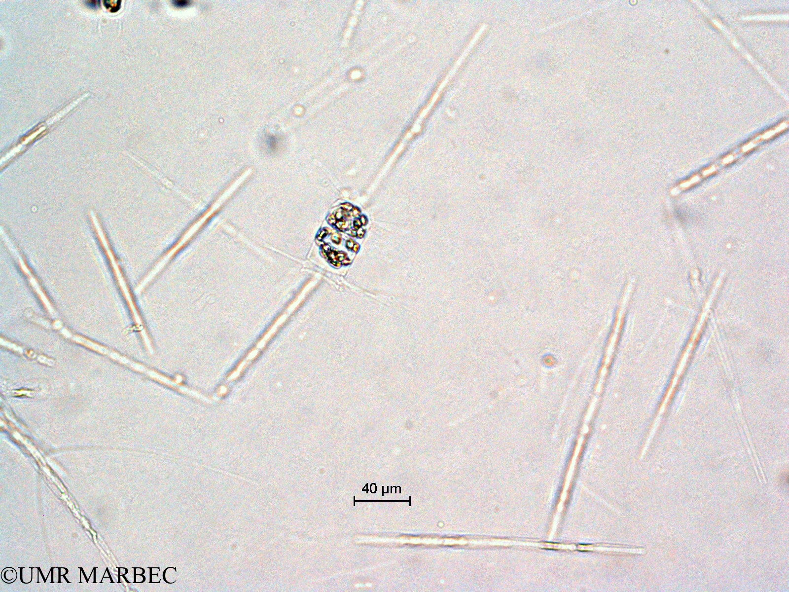 phyto/Scattered_Islands/all/COMMA April 2011/Bacteriastrum furcatum (ancien Bacteriastrum sp10 -2)(copy).jpg